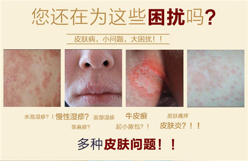 稀土元素喷剂 报价『RMB』一盒多少钱 卖方-