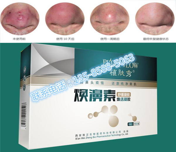 植肤秀焕濞素 --价格多少「一般价格」-青青岛