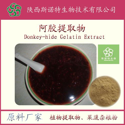 sinuote2016$102691558.jpg