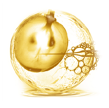 ʩɰ˹Ũ